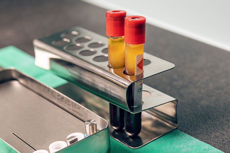 Blood in a tube for PRF treatment